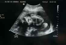 Wolverhampton Wanderers F.C. Vs Arsenal F.C. Stats Revealed Wolverhampton Wanderers F.C. Vs Arsenal F.C. Stats Revealed # Wolverhampton Wanderers F.C. Vs Arsenal F.C. Stats Revealed