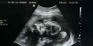 Wolverhampton Wanderers F.C. Vs Arsenal F.C. Stats Revealed Wolverhampton Wanderers F.C. Vs Arsenal F.C. Stats Revealed # Wolverhampton Wanderers F.C. Vs Arsenal F.C. Stats Revealed